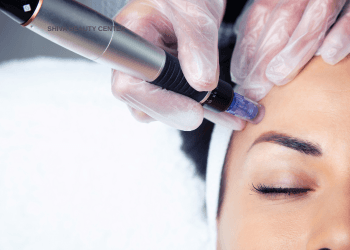 Microneedling profesional